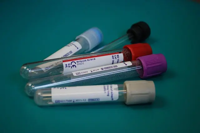 Comment comparer les prix des médicaments en ligne