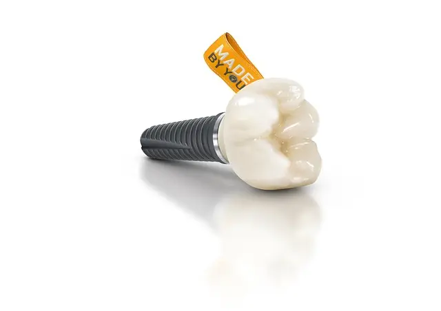 Comment choisir le vitrage parfait pour votre remplacement de vitre
